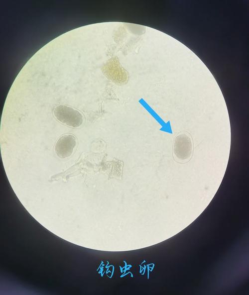 larva 幼虫 的复数形式是什么